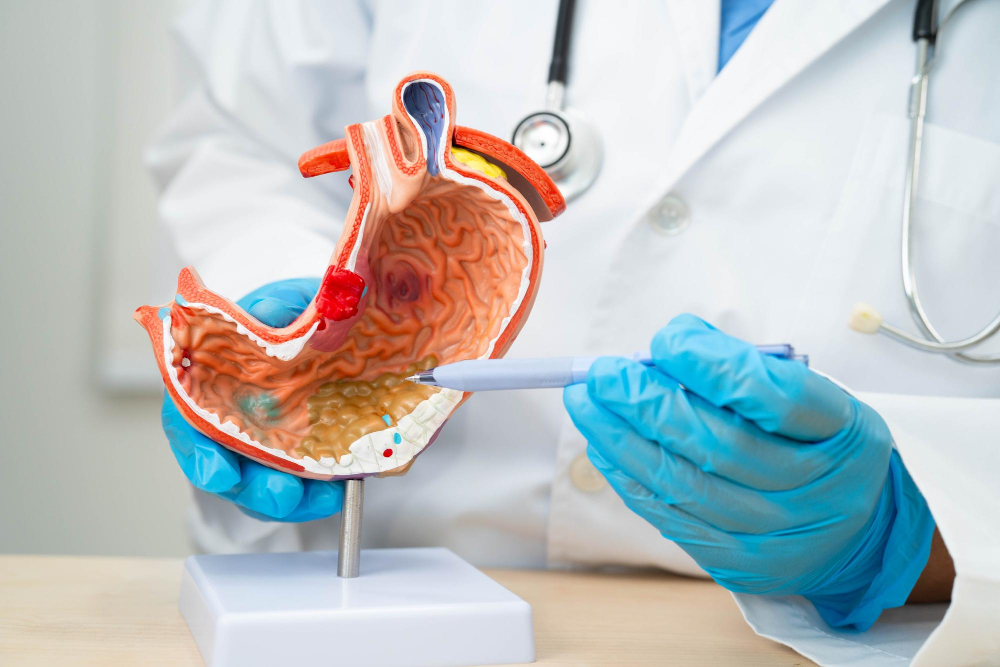 Cirugía del Aparato Digestivo: Atención Especializada del Dr. Oscar Isaac Hernández Palmas