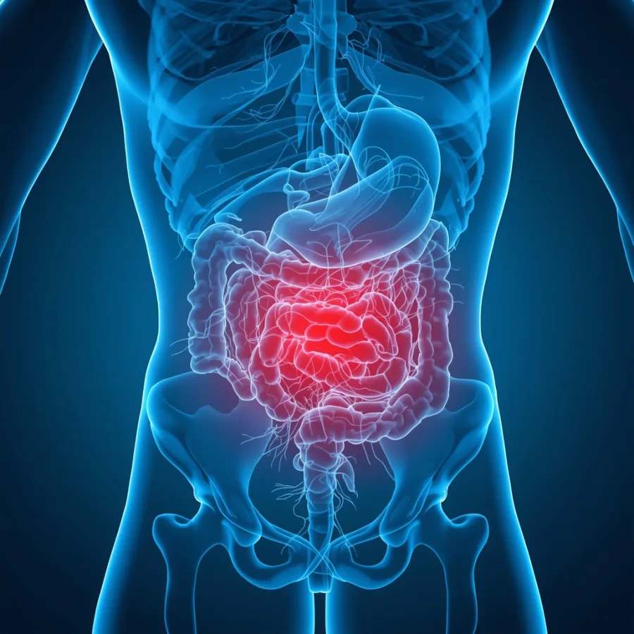 Hernia hiatal en Pachuca: evaluación y manejo por cirujano general